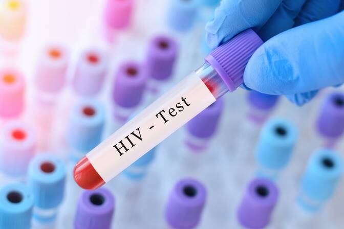 Ulusal HIV Test Günü
