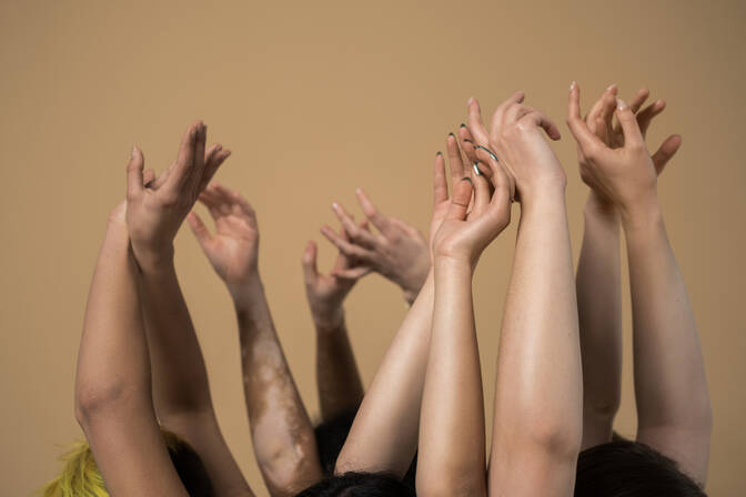 Giornata mondiale della vitiligine