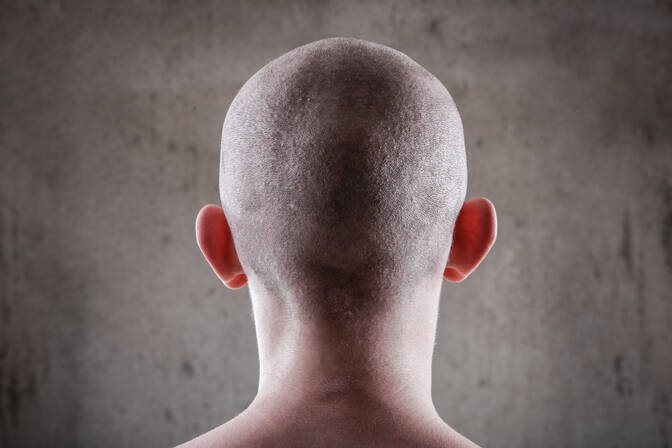 Bald is Beautiful Day